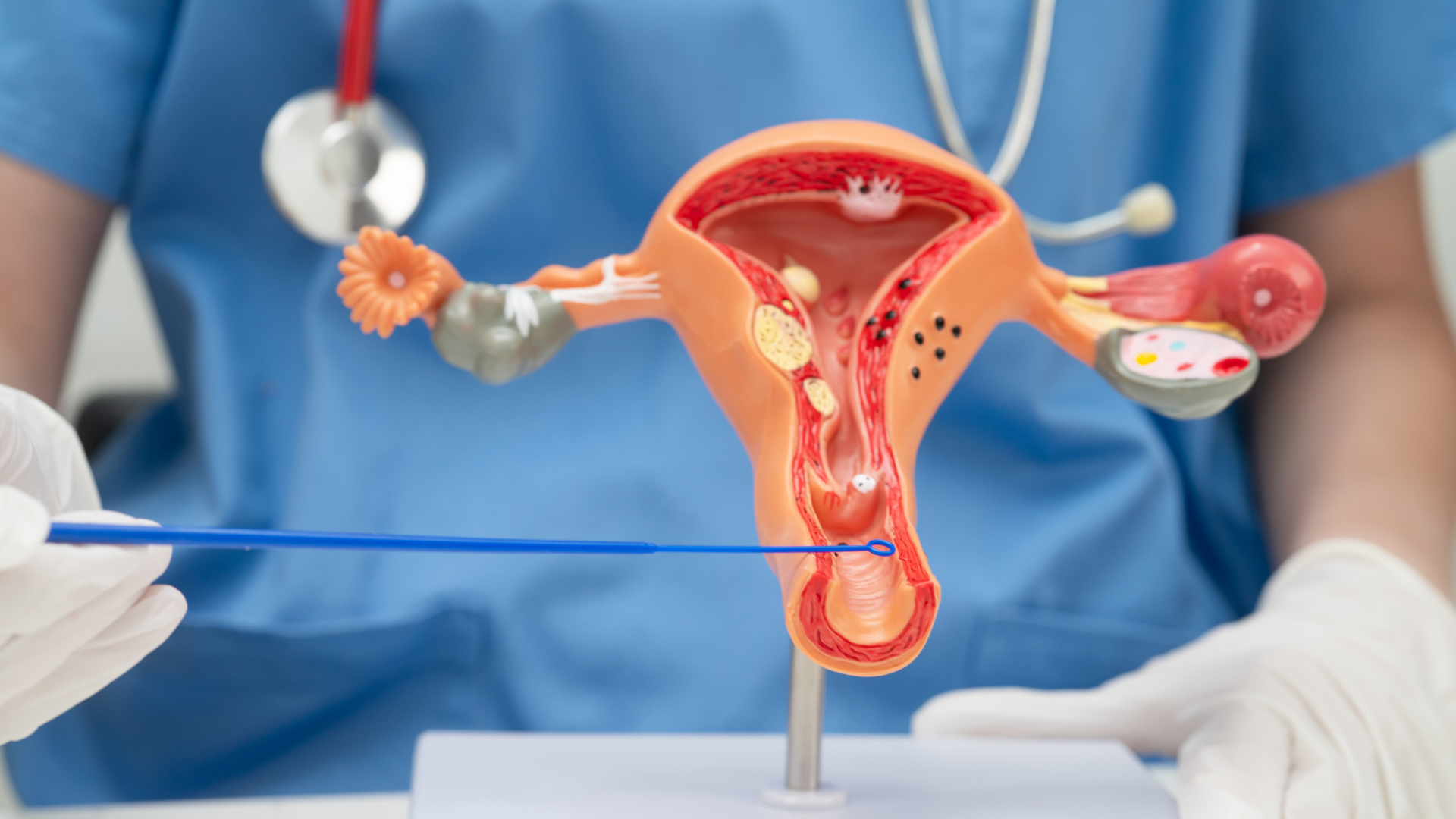 Candidosi: come curarla quando prende il sopravvento​